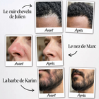 Malo Sérum Régulateur