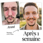 Malo Sérum Régulateur