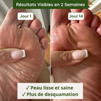 Savon Anti-Mycoses Malo Cosmetic