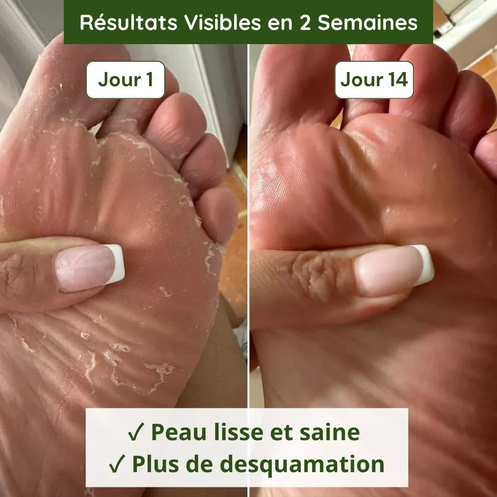 Savon Anti-Mycoses Malo Cosmetic