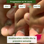 Savon Anti-Mycoses Malo Cosmetic