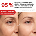 95 % ont vu leurs pattes-d'oie et ridules visiblement adoucies — avant/après